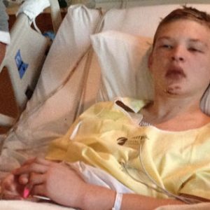 Teen stung over 600 times after inserting his Pen1s inside Beehive